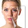 KINLITO Ionic Facial Steamer Beauty Care-5